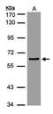Eukaryotic Translation Initiation Factor 3 Subunit D antibody, PA5-27411, Invitrogen Antibodies, Western Blot image 