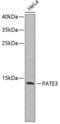 Prostate And Testis Expressed 3 antibody, 18-571, ProSci, Western Blot image 