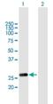 RAB20, Member RAS Oncogene Family antibody, H00055647-B01P, Novus Biologicals, Western Blot image 