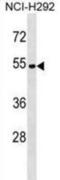 ATPase H+ Transporting V1 Subunit C2 antibody, abx029803, Abbexa, Western Blot image 