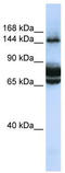 Family With Sequence Similarity 83 Member B antibody, TA334927, Origene, Western Blot image 