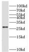 Brain Expressed X-Linked 3 antibody, FNab05721, FineTest, Western Blot image 