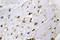 Cyclin Dependent Kinase 2 antibody, LS-C176902, Lifespan Biosciences, Immunohistochemistry paraffin image 