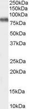 Potassium Voltage-Gated Channel Subfamily C Member 3 antibody, GTX89119, GeneTex, Western Blot image 