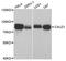 Caldesmon 1 antibody, A5366, ABclonal Technology, Western Blot image 