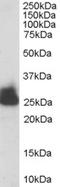 Triosephosphate Isomerase 1 antibody, EB06643, Everest Biotech, Western Blot image 