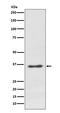 Syndecan 1 antibody, M00991, Boster Biological Technology, Western Blot image 