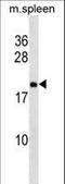 Ribosomal Protein L9 antibody, LS-C158245, Lifespan Biosciences, Western Blot image 