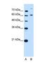 BMP2 Inducible Kinase antibody, NBP1-52901, Novus Biologicals, Western Blot image 