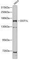 DOT1 Like Histone Lysine Methyltransferase antibody, 23-059, ProSci, Western Blot image 