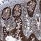 Sirtuin 5 antibody, NBP1-89535, Novus Biologicals, Immunohistochemistry frozen image 
