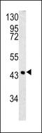 Serpin Family B Member 3 antibody, MBS9212535, MyBioSource, Western Blot image 