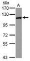 Huntingtin Interacting Protein 1 Related antibody, PA5-30863, Invitrogen Antibodies, Western Blot image 