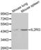 Interleukin 2 Receptor Subunit Gamma antibody, abx001511, Abbexa, Western Blot image 