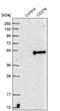 CD276 Molecule antibody, NBP1-88965, Novus Biologicals, Western Blot image 