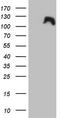 Dishevelled Segment Polarity Protein 2 antibody, TA806918, Origene, Western Blot image 