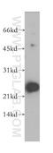 Nucleoside diphosphate kinase homolog 5 antibody, 12923-1-AP, Proteintech Group, Western Blot image 
