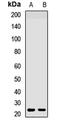 Heart And Neural Crest Derivatives Expressed 2 antibody, LS-C668557, Lifespan Biosciences, Western Blot image 