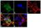 Adaptor Related Protein Complex 2 Subunit Beta 1 antibody, GTX79316, GeneTex, Immunocytochemistry image 