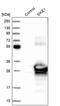 Suppressor Of IKBKE 1 antibody, PA5-55003, Invitrogen Antibodies, Western Blot image 