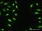 Zinc Finger Protein 124 antibody, H00007678-D01P, Novus Biologicals, Immunofluorescence image 