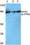 Signal Transducer And Activator Of Transcription 5A antibody, PA5-36688, Invitrogen Antibodies, Western Blot image 