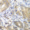 Cyclin Dependent Kinase 1 antibody, STJ113562, St John
