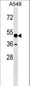 Amylase Alpha 1C (Salivary) antibody, LS-C161060, Lifespan Biosciences, Western Blot image 