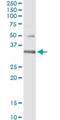 HUS1 Checkpoint Clamp Component antibody, H00003364-M01, Novus Biologicals, Immunoprecipitation image 