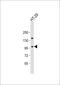 Ataxin 1 antibody, 61-519, ProSci, Western Blot image 
