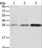 AlkB Homolog 2, Alpha-Ketoglutarate Dependent Dioxygenase antibody, LS-C404409, Lifespan Biosciences, Western Blot image 