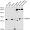 Charged Multivesicular Body Protein 1B antibody, GTX32520, GeneTex, Western Blot image 
