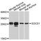 Suppressor Of Cytokine Signaling 1 antibody, STJ111032, St John
