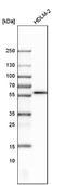 FAS antibody, NBP1-89034, Novus Biologicals, Western Blot image 