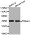 E3 ubiquitin-protein ligase TRIM41 antibody, LS-C332637, Lifespan Biosciences, Western Blot image 
