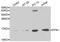 Profilin 1 antibody, A1164, ABclonal Technology, Western Blot image 