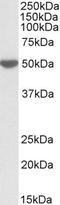 Stabilin 1 antibody, orb20458, Biorbyt, Western Blot image 