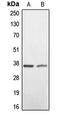 BCL2 Interacting Protein 2 antibody, LS-C351874, Lifespan Biosciences, Western Blot image 