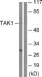 Mitogen-Activated Protein Kinase Kinase Kinase 7 antibody, abx012835, Abbexa, Western Blot image 