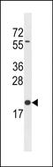 Biogenesis Of Lysosomal Organelles Complex 1 Subunit 3 antibody, PA5-49260, Invitrogen Antibodies, Western Blot image 