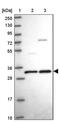 Transmembrane P24 Trafficking Protein 5 antibody, PA5-62164, Invitrogen Antibodies, Western Blot image 