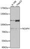 Non-SMC Condensin I Complex Subunit H antibody, GTX64648, GeneTex, Western Blot image 