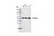 Tubulin antibody, 6181S, Cell Signaling Technology, Western Blot image 