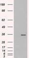 Growth Differentiation Factor 15 antibody, GTX89503, GeneTex, Western Blot image 