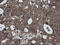 RIO Kinase 2 antibody, M09743, Boster Biological Technology, Immunohistochemistry paraffin image 