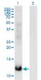 Methionine Sulfoxide Reductase B2 antibody, MA5-21370, Invitrogen Antibodies, Western Blot image 