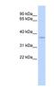 Sideroflexin 3 antibody, NBP1-59728, Novus Biologicals, Western Blot image 