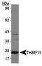 THAP domain-containing protein 11 antibody, TA309909, Origene, Western Blot image 