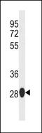 Suppressor Of IKBKE 1 antibody, PA5-49286, Invitrogen Antibodies, Western Blot image 