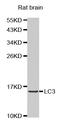 Microtubule Associated Protein 1 Light Chain 3 Beta antibody, abx001904, Abbexa, Western Blot image 